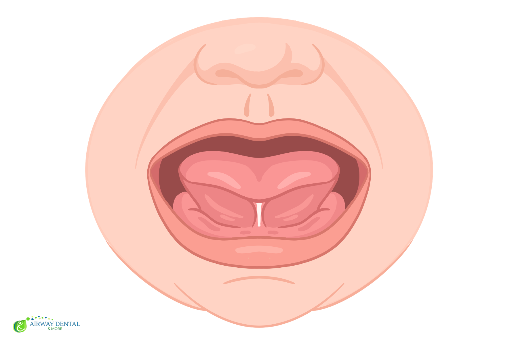 Illustration of the tissue beneath a raised tongue